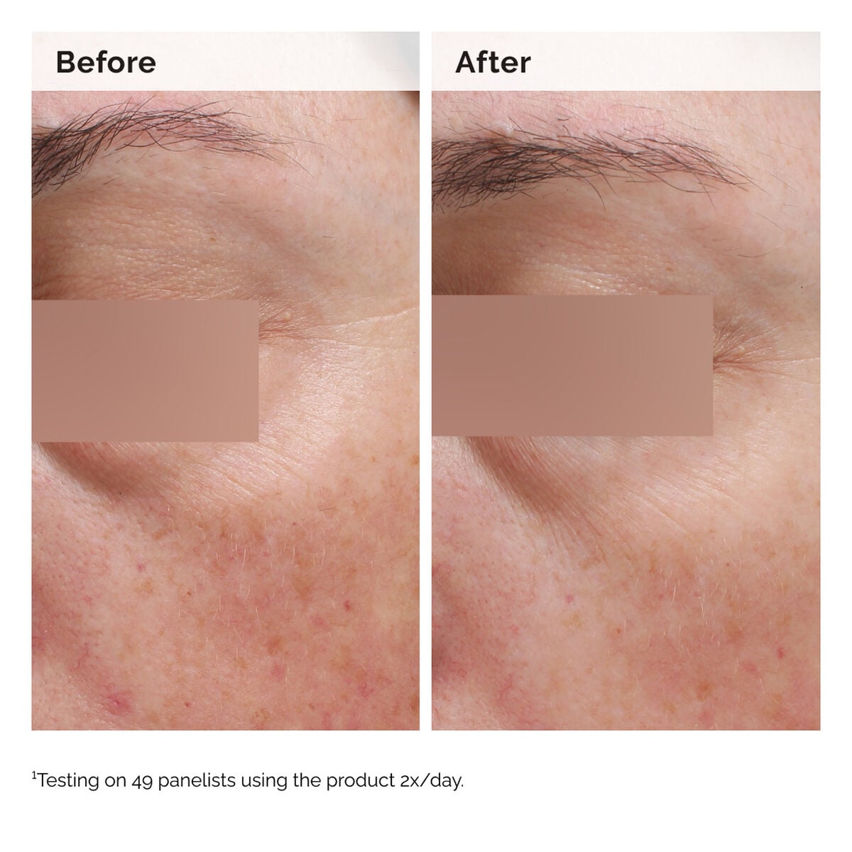 niacinamide-5-face-and-body-emulsion-l6 2024-08-23-ORD-Nia-5pct-Face-Body-B-A-Elasticity-Global-02-1x1.jpg
