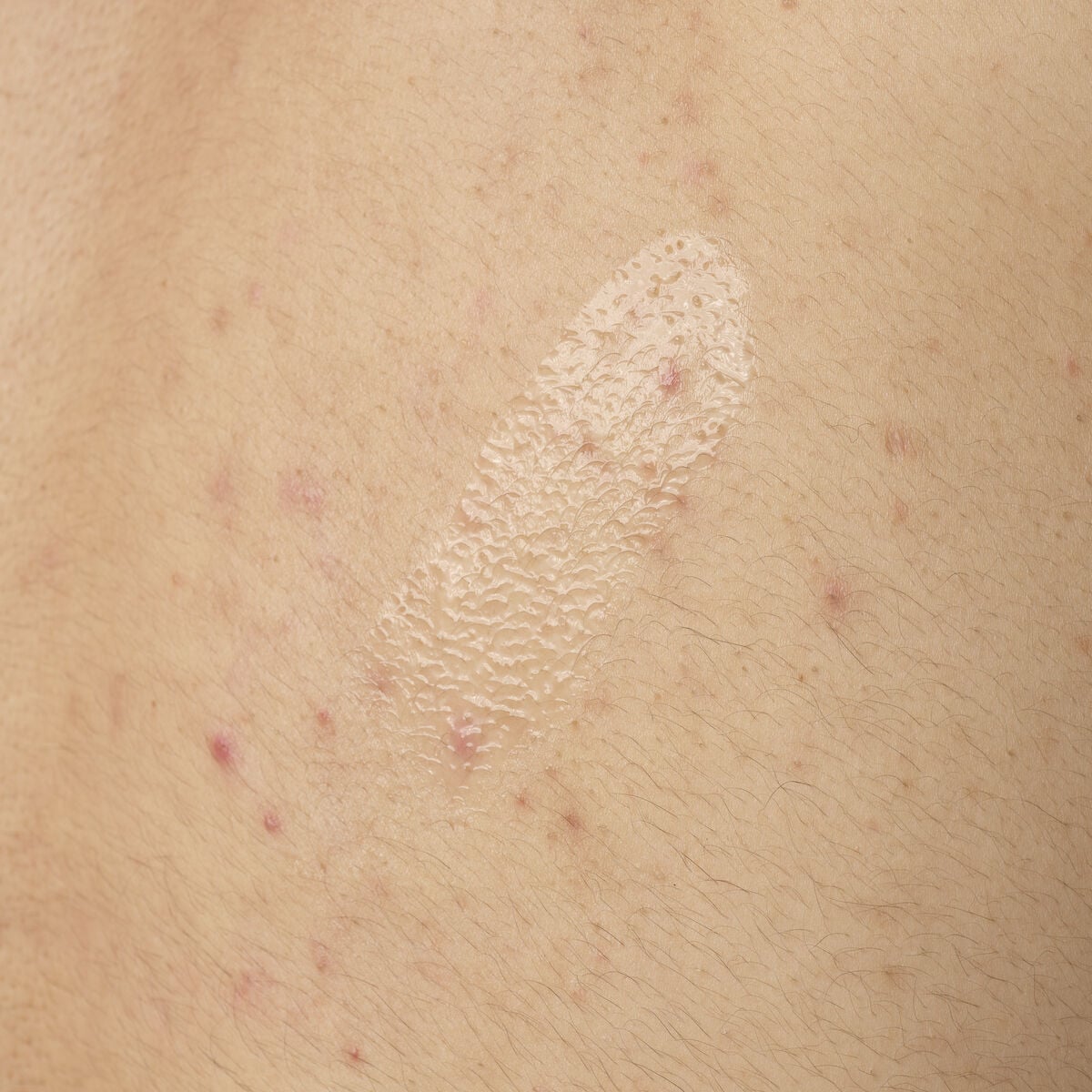 salicylic-acid-0-5-body-serum-u6 ORD-salicylic-acid-05-body-240ml-application.jpg