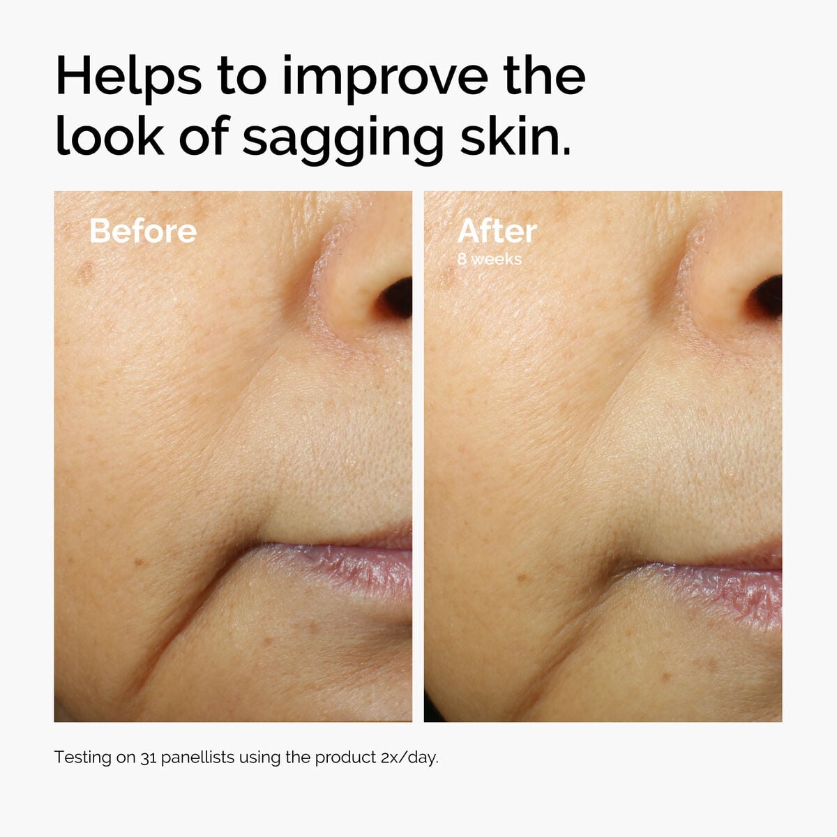 caffeine-3-escin-1-face-serum-k9 ord-caffeine-3pct-escin-1pct-face-serum-before-after-sagging.jpg