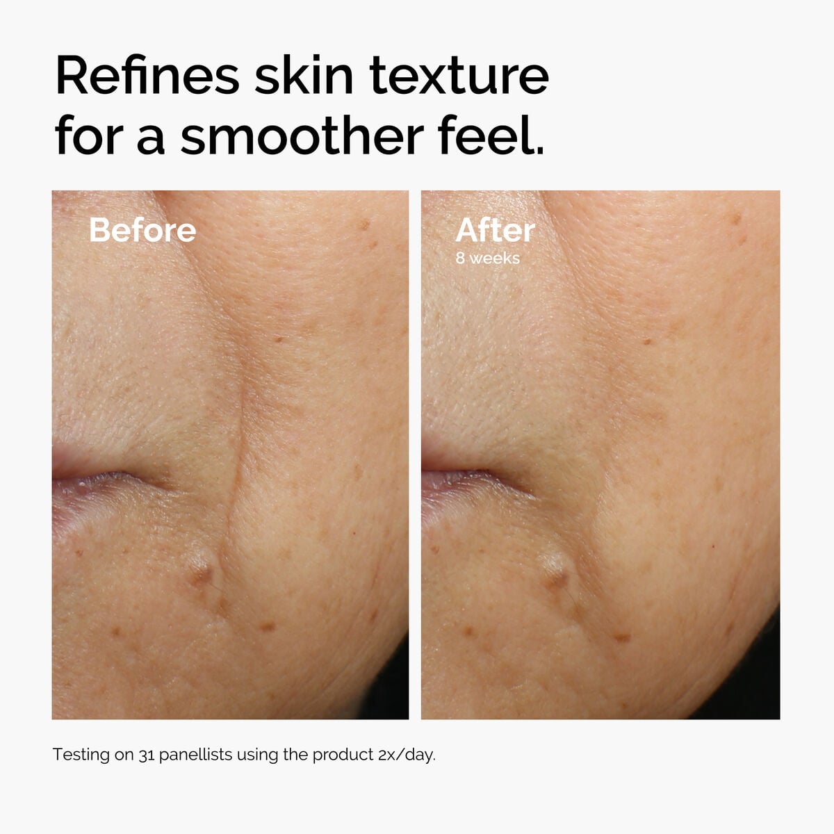 caffeine-3-escin-1-face-serum-k9 ord-caffeine-3pct-escin-1pct-face-serum-before-after-texture.jpg