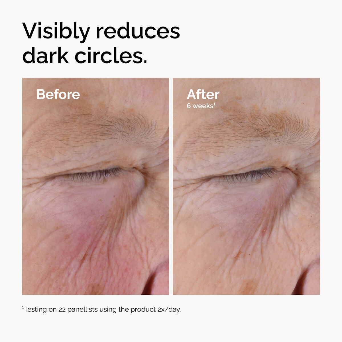 caffeine-solution-5-egcg-eye-serum-e1 ord-caffeine-solution-egcg-dark-circles-before-after.jpg