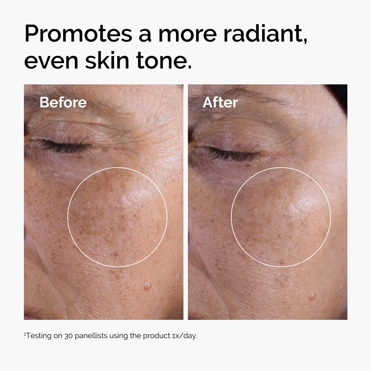 glycolic-acid-7-exfoliating-toner-y7 ord-glycolic-before-after-radiance.jpg