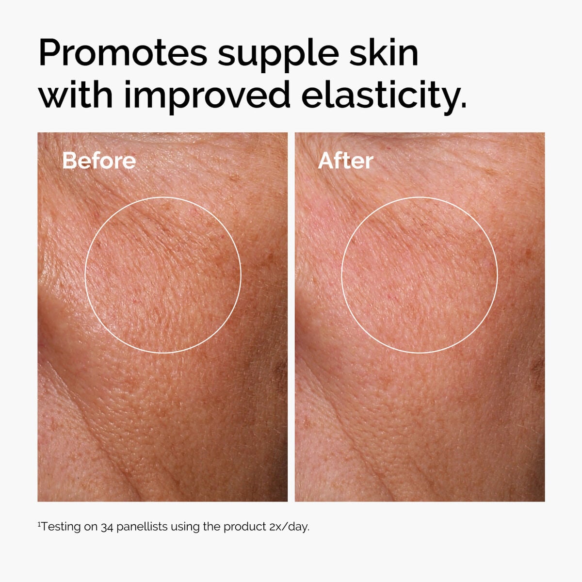 hyaluronic-acid-2-b5-with-ceramides-u5 ord-hyaluronic-acid-2pct-b5-hydrating-serum-before-after-elasticity.jpg