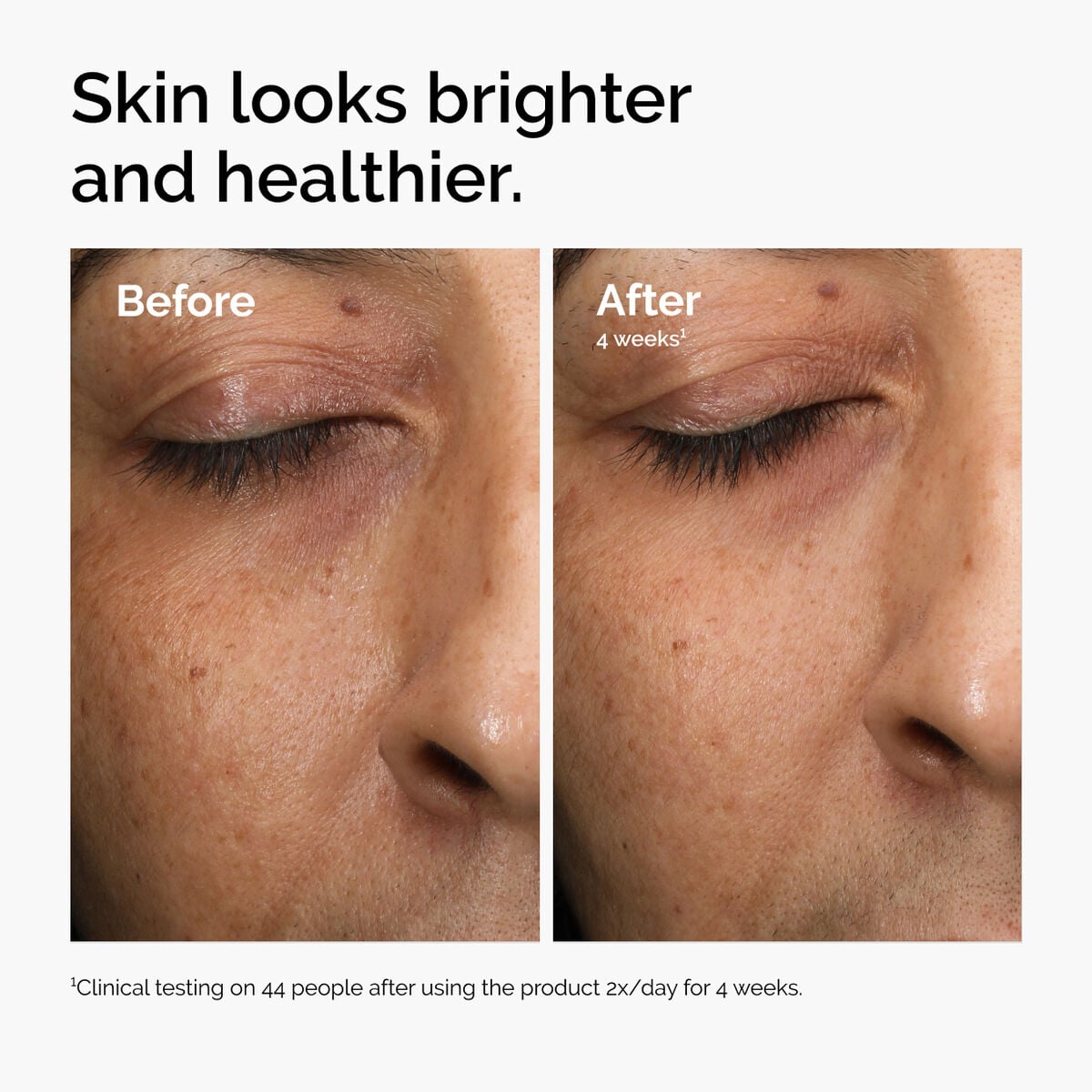 multi-antioxidant-radiance-serum-k9 ord-mars-before-after-healthy.jpg