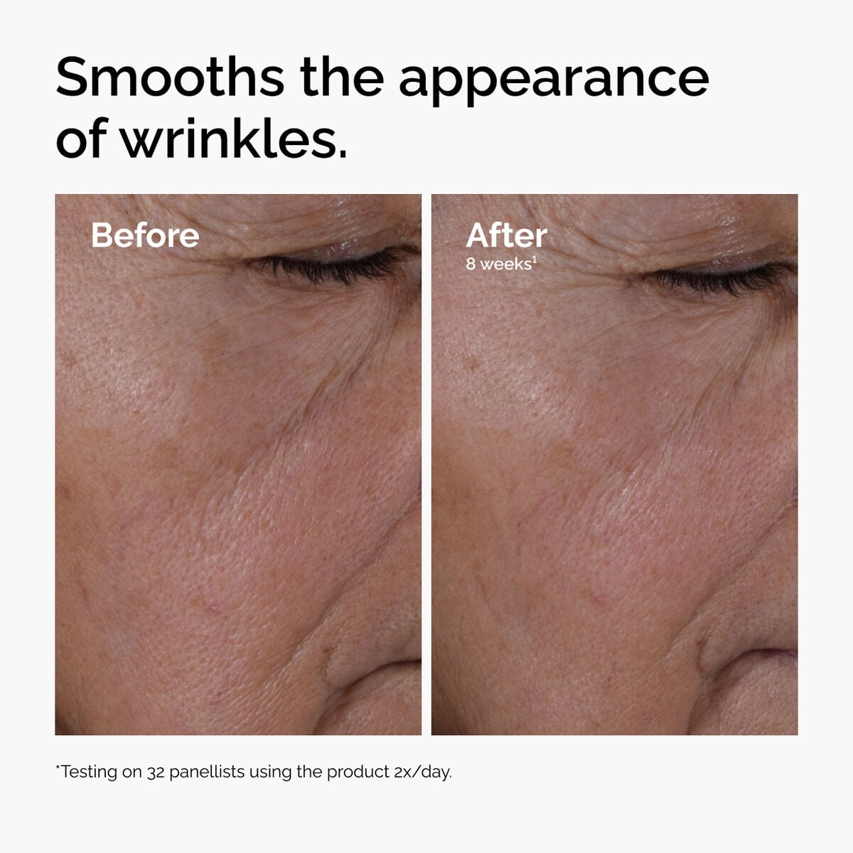 multi-peptide-ha-serum-z6 ord-multi-peptide-ha-serum-wrinkles-before-after.jpg