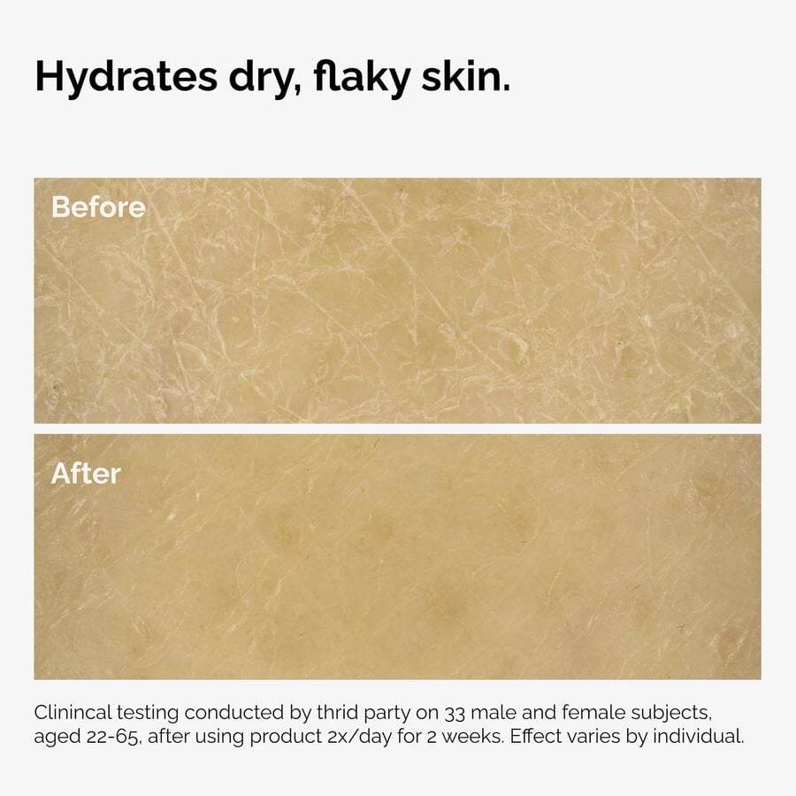 the-body-care-collection-f8 ord-natural-moisturizing-factors-inulin-body-before-after-graphic-02.jpg