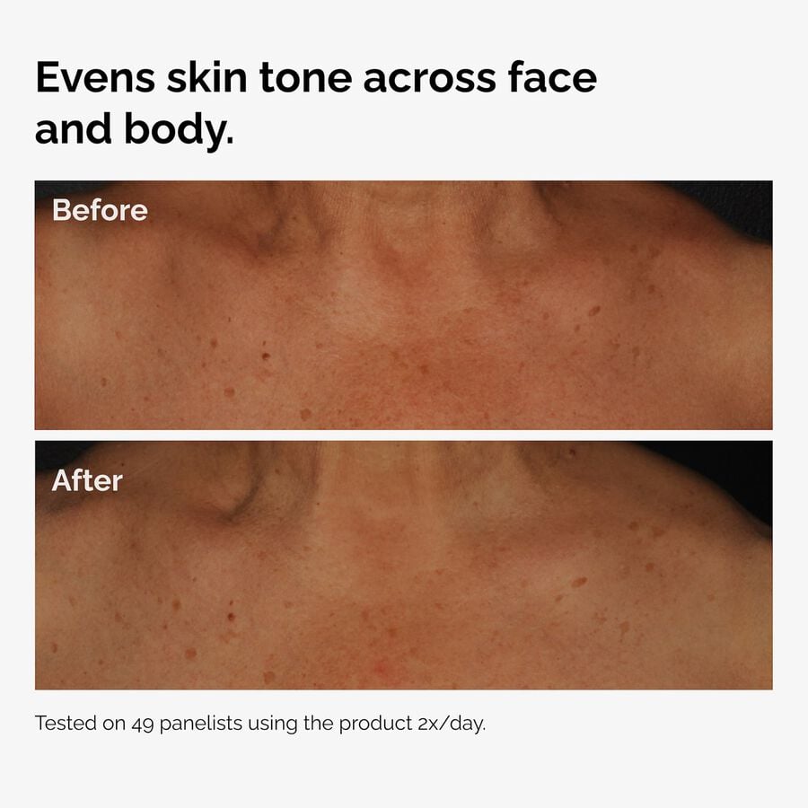 the-body-care-collection-f8 ord-niacinamide-face-body-serum-before-after-even-tone-graphic.jpg