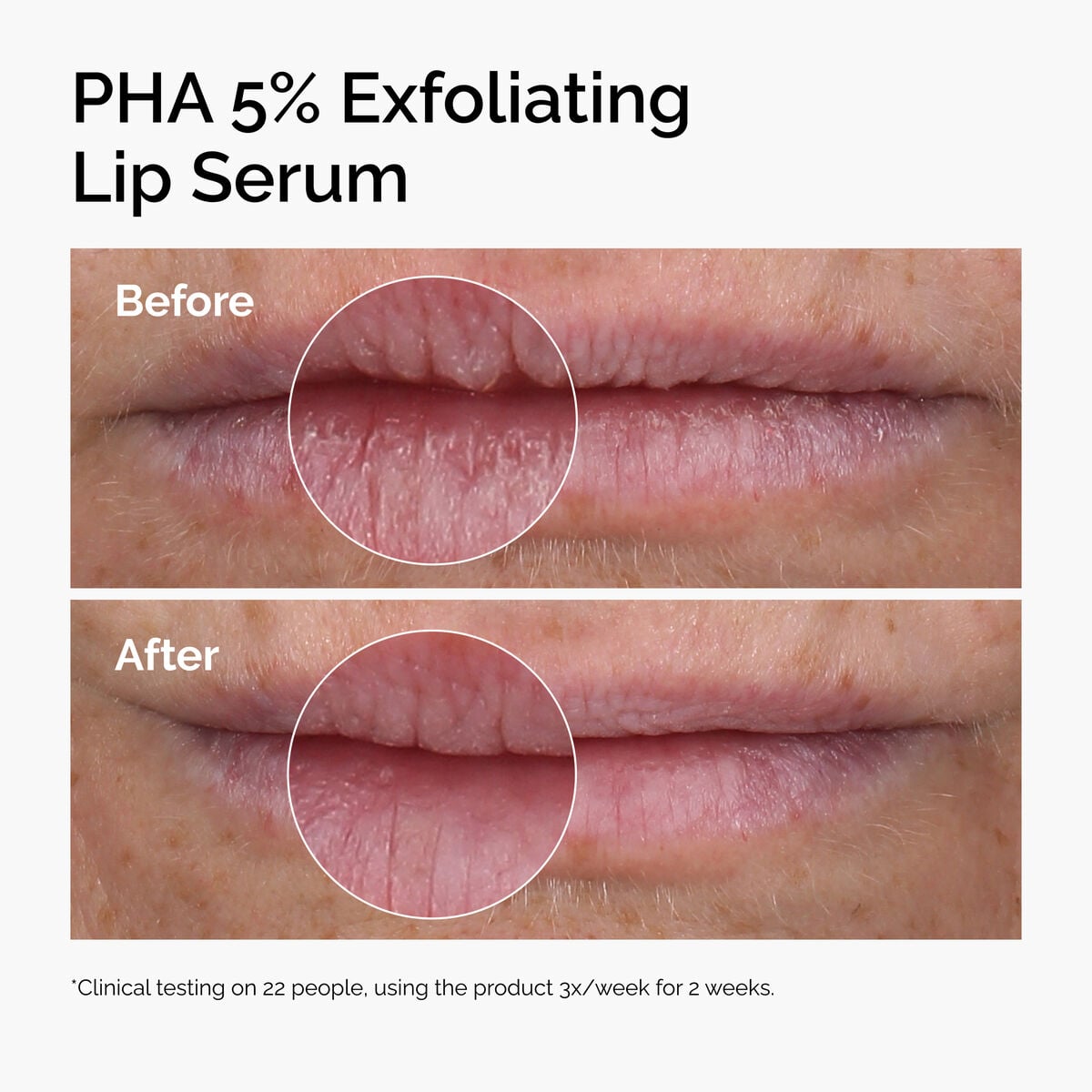 pha-5-exfoliating-lip-serum-y8 ord-pha-5pct-lip-exfoliating-serum-before-after.jpg